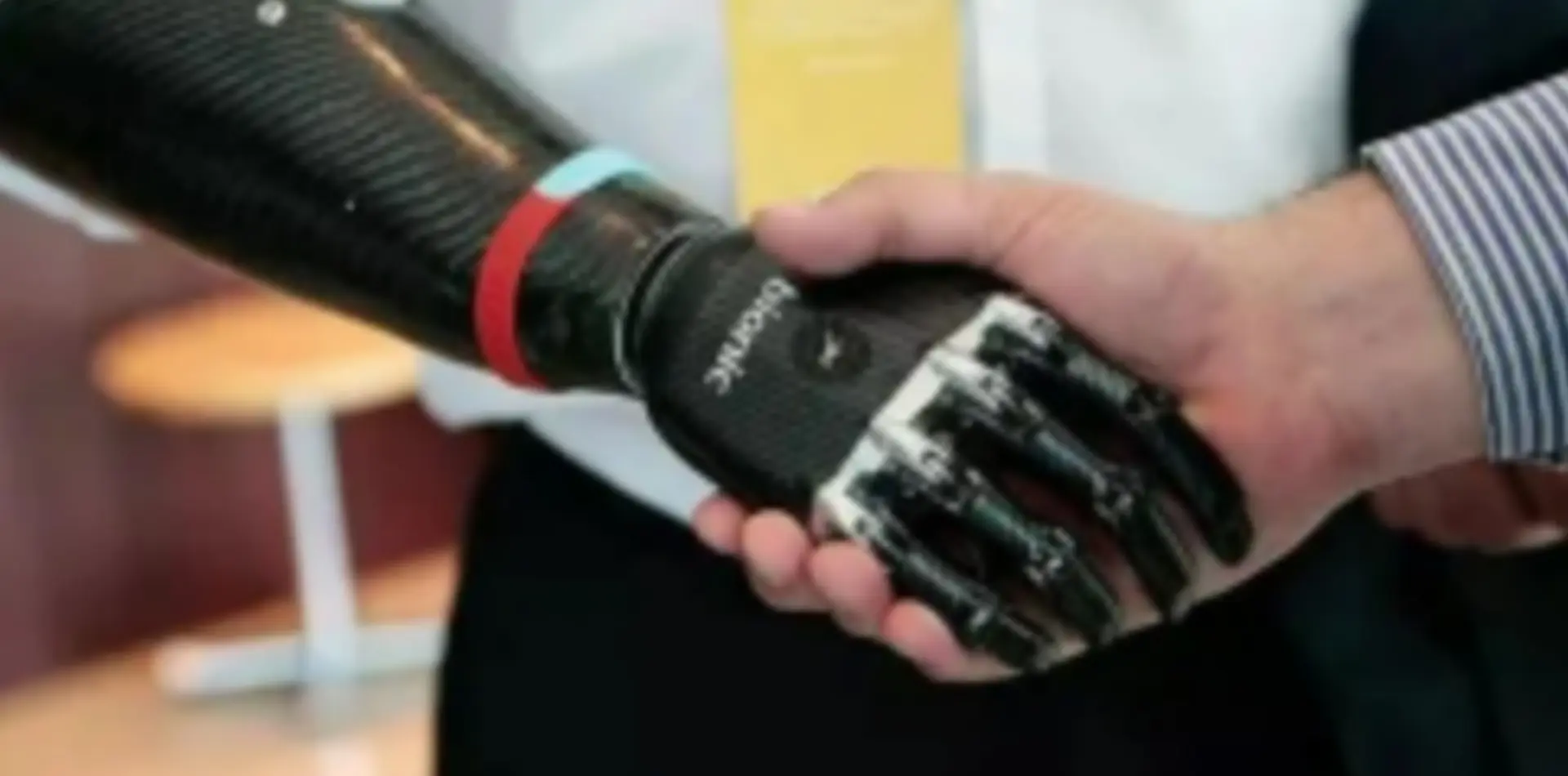 CFRP prosthetic limb
