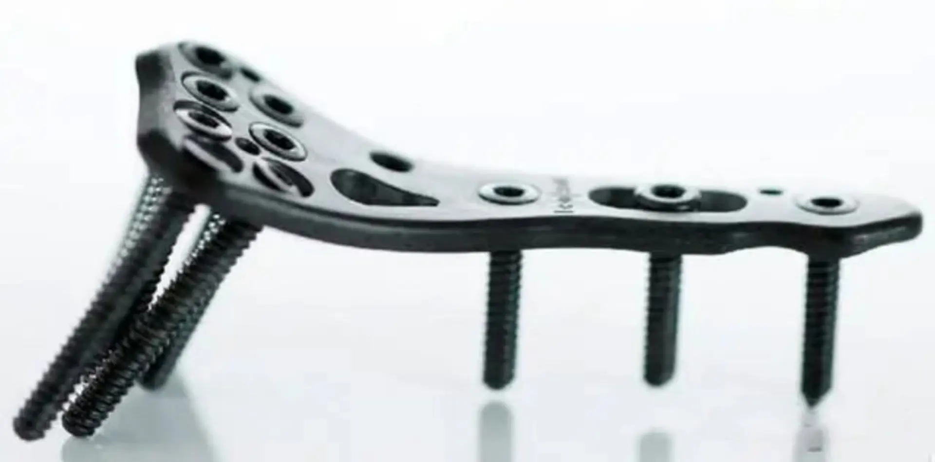 Carbon fiber PEEK spinal implant